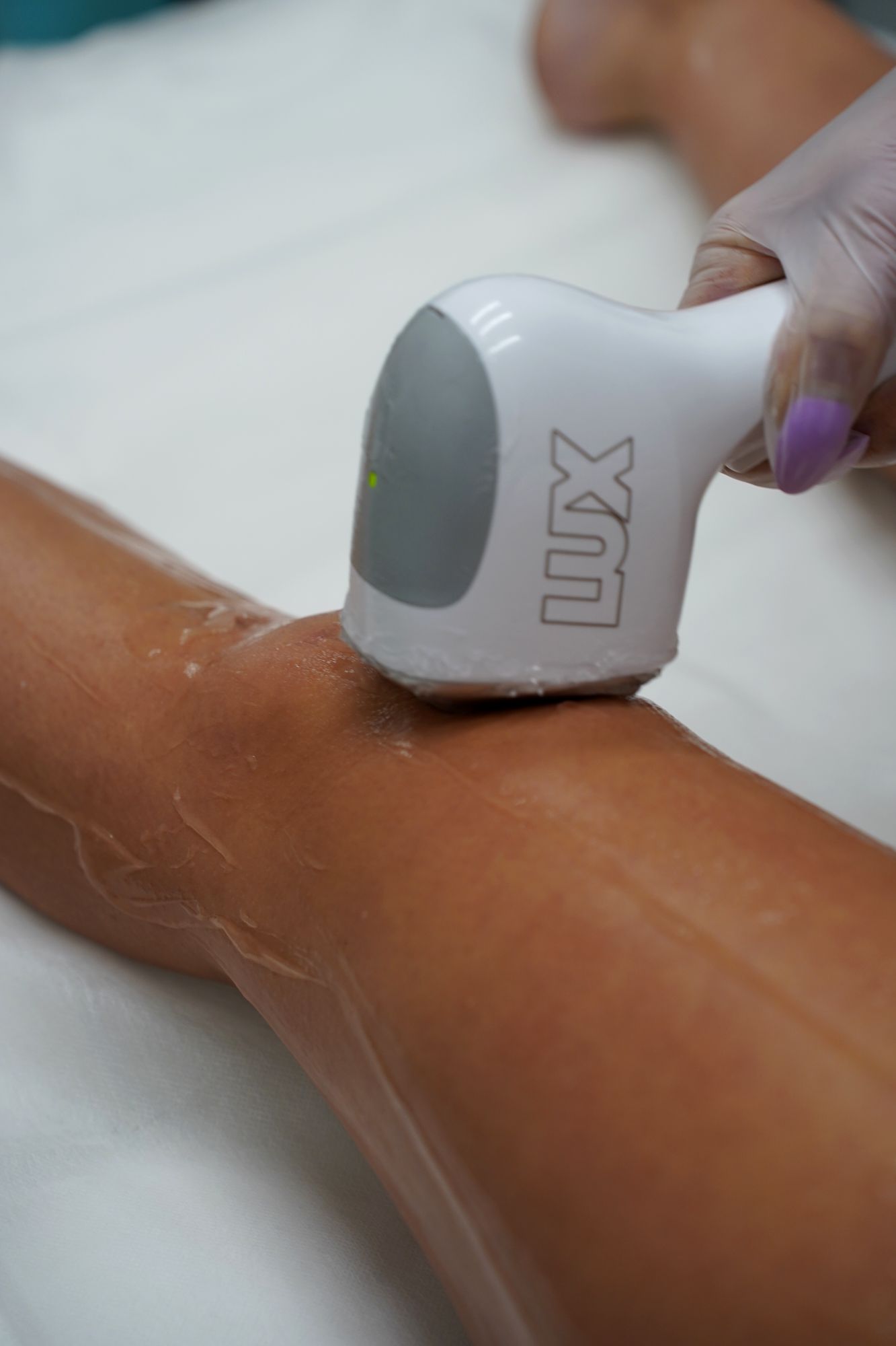 The Skyn Lux handpiece on a client's lower leg