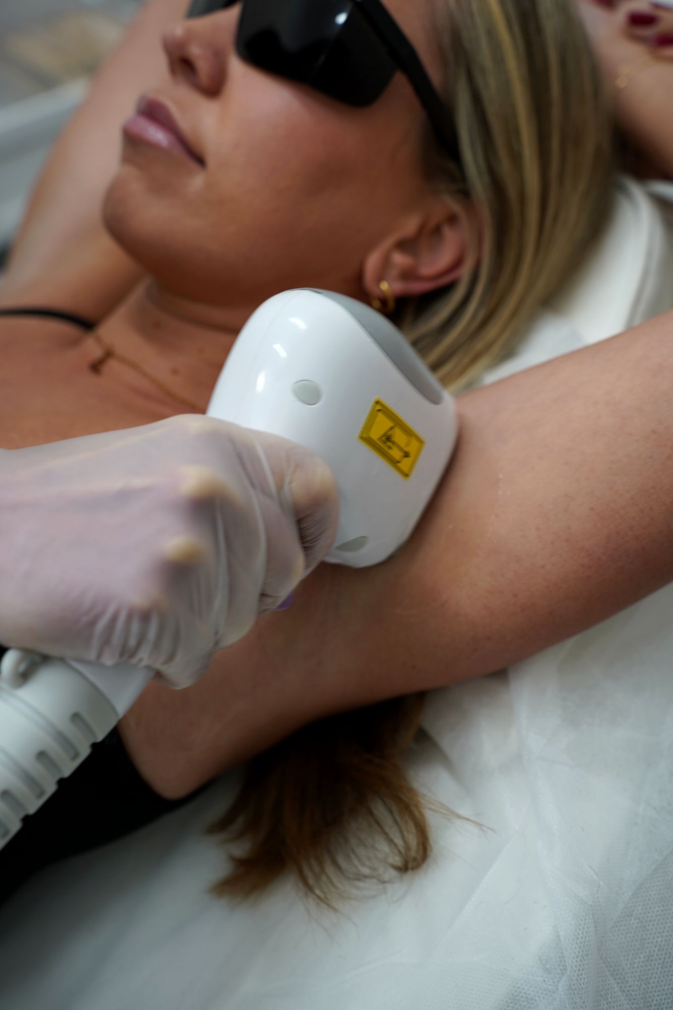 A client in protective glasses having underarm laser treatment