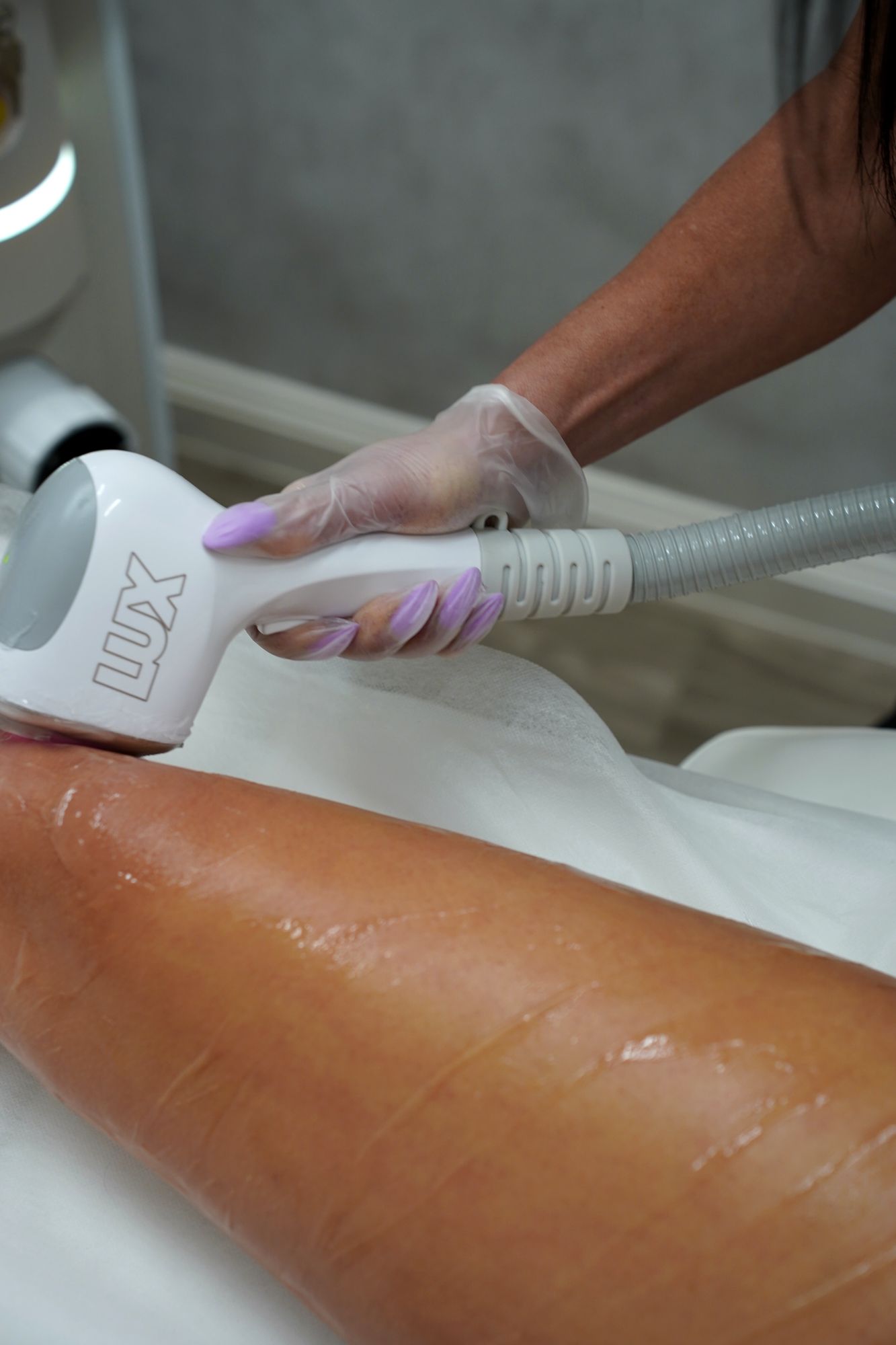 Close view of the laser handpiece gliding over a leg